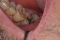 Oral Galvanic Currents_04.Jpg